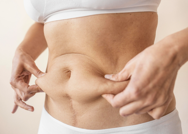 Excess Loose Skin & Loss of Skin Elasticity